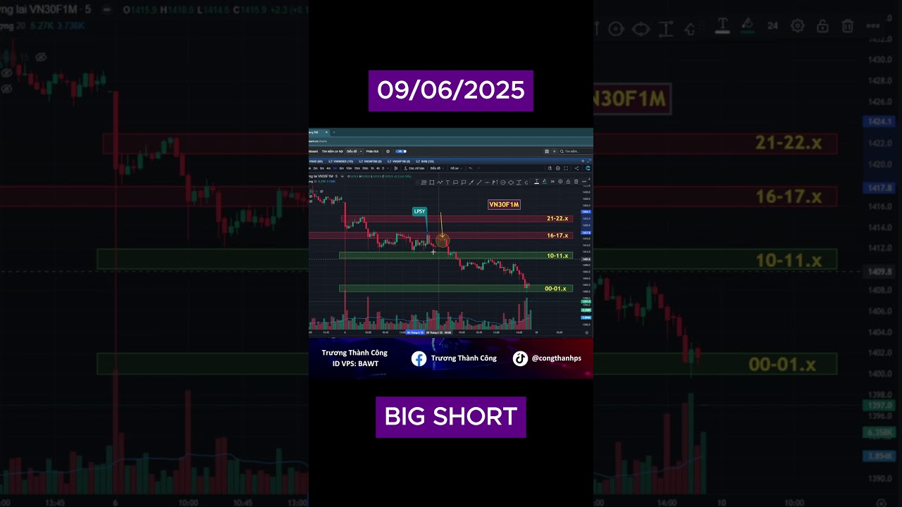B&Iacute; K&Iacute;P PH&Aacute;I SINH - BIG SHORT #shortsvideo
