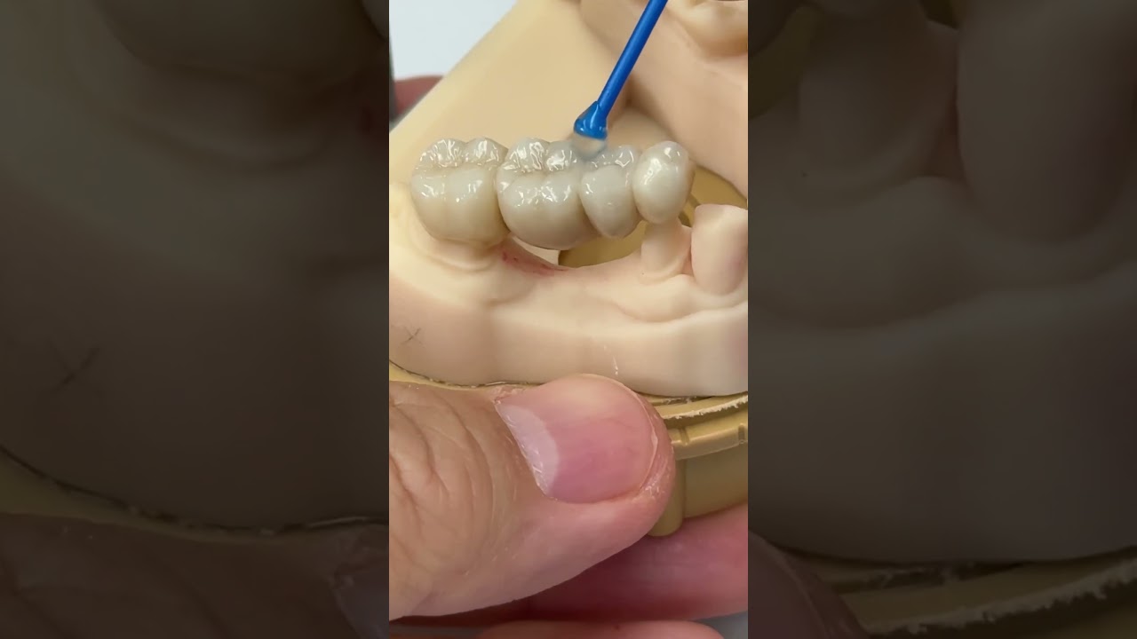 4 unit Zirconia! @EnvisiontecMain #envisiontec