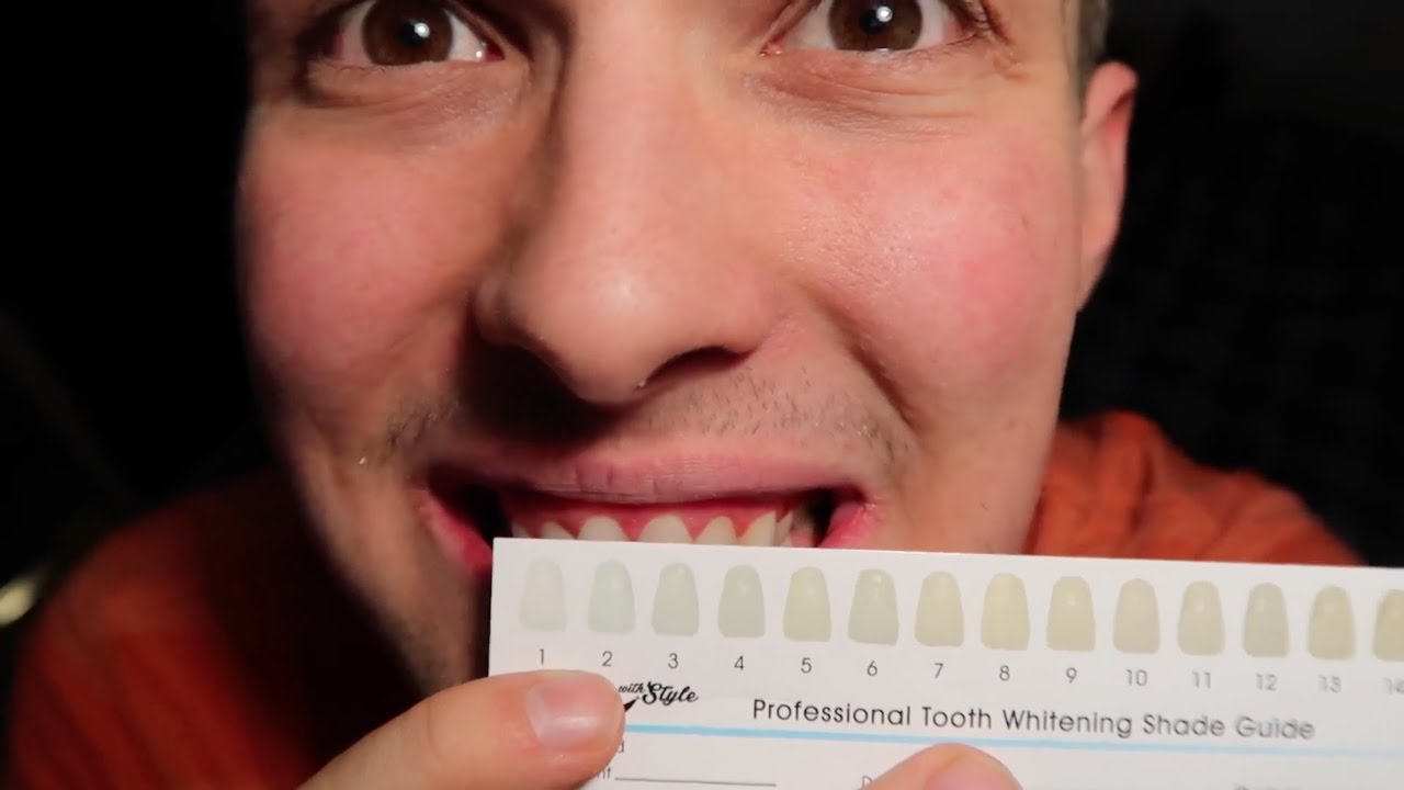 Craziest 30 Minutes of My Life! | White With Style Teeth Whitening Experiment
