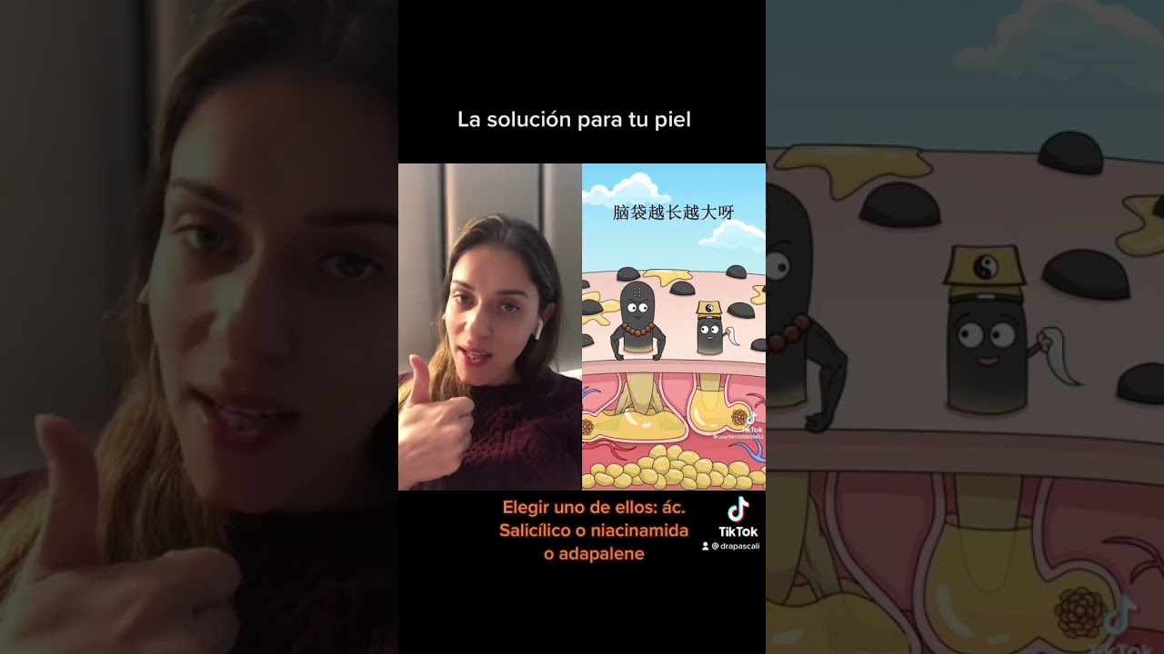 Ma soluci&oacute;n para los filamentos seb&aacute;ceos #shorts