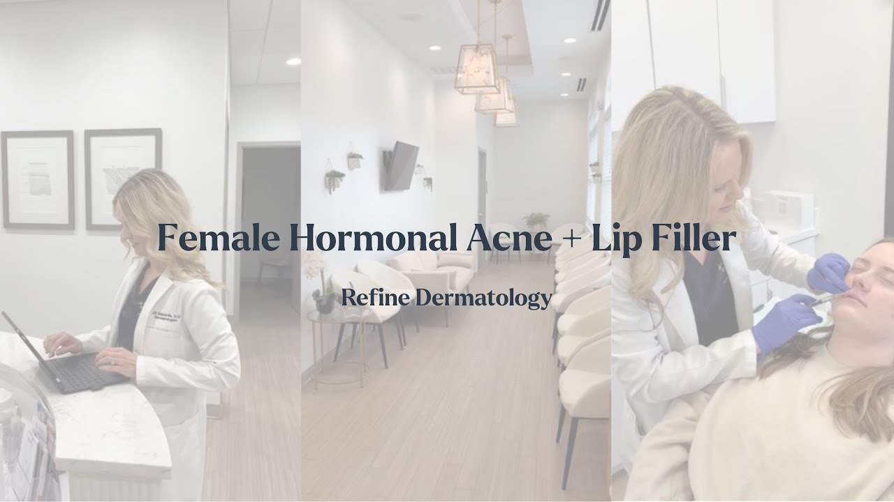 Adult Hormonal Acne | Lip Filler | Skin Checks