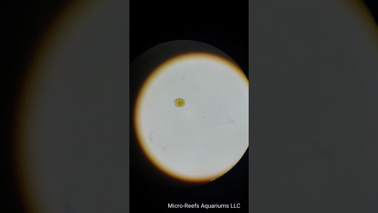 Dinoflagellates (Amphidinium)?