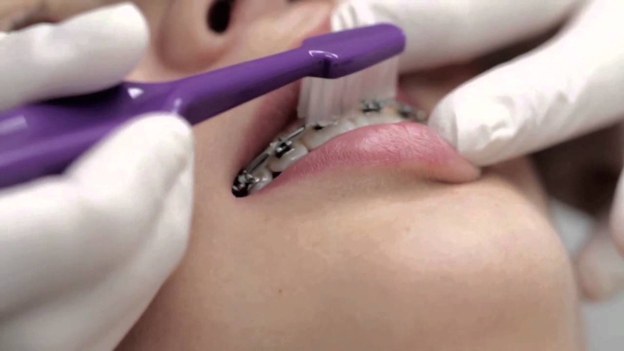 Gladatänder Informationsfilm