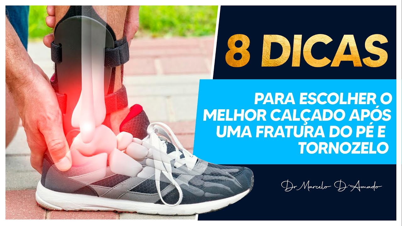 ESCOLHA O MELHOR CALÇADO PARA EVITAR DORES E DESCONFORTOS APÓS UMA FRATURA - 8 DICAS DO DR. MARCELO