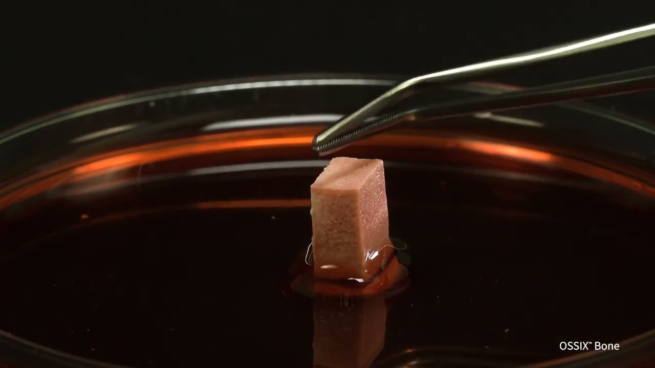 OSSIX™ Bone: Revealing Essential Features in a Brief Video