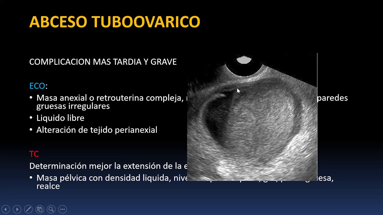 Abdomen Agudo Ginecologico (Parte 1)