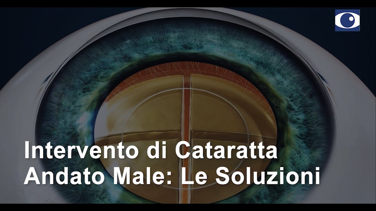 INTERVENTO DI CATARATTA ANDATO MALE: LE SOLUZIONI
