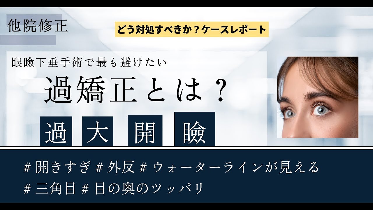 眼瞼下垂手術の過矯正（過大開瞼）の難治療に挑む