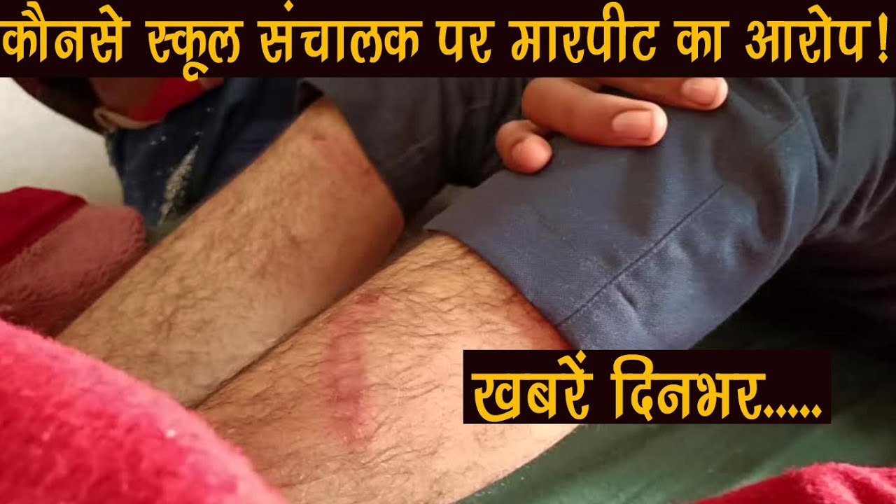 सुजानगढ़-कौनसे स्कूल संचालक पर बालक की पिटाई का आरोप?खबरें दिनभर.....18-01-26