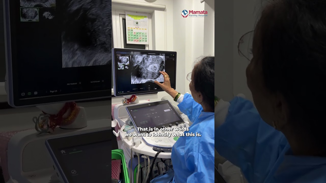 Endometrial Cavity Mass Explained: Sonohysterogram Case | Mamata Fertility Hospital: Hyderabad