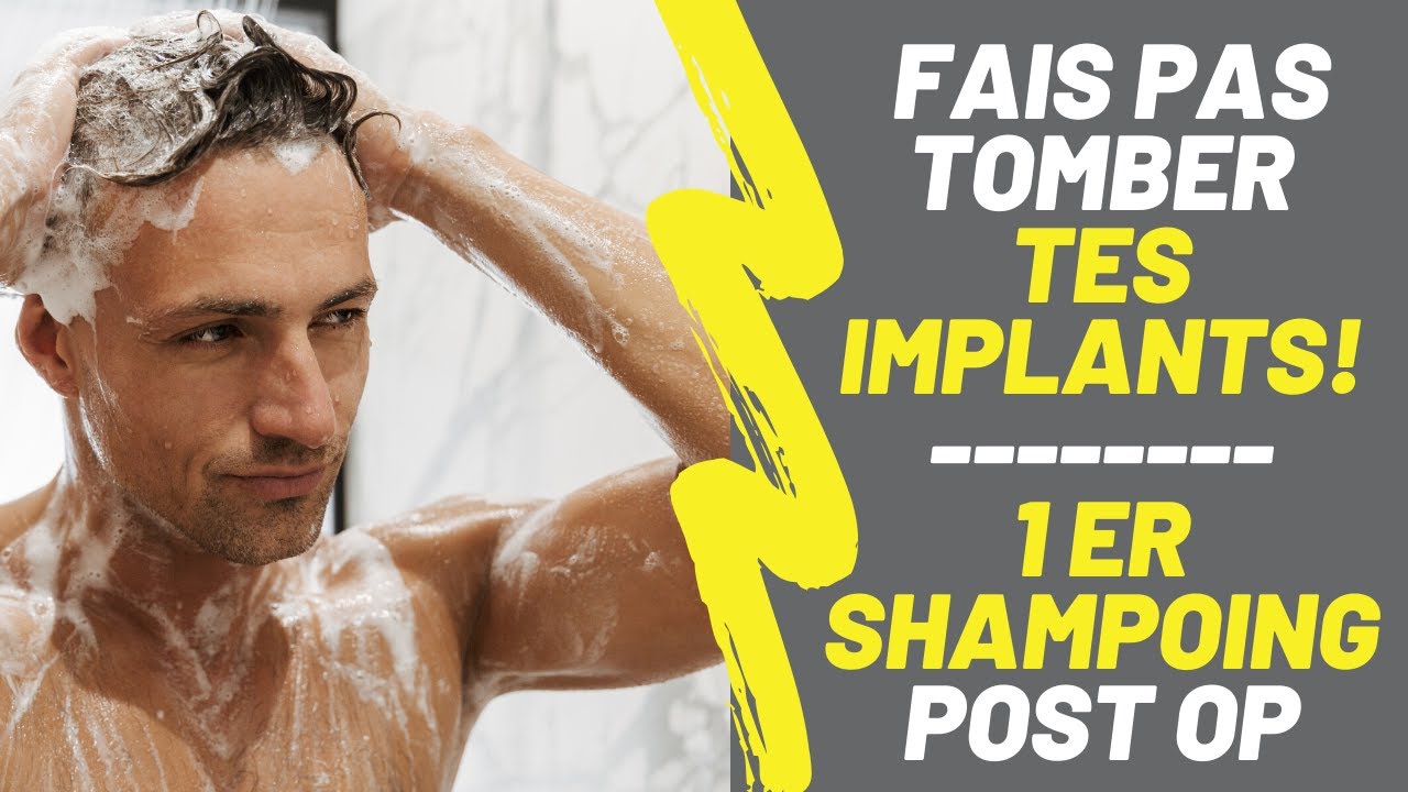 [GREFFE de CHEVEUX] FAIS PAS TOMBER TES IMPLANTS pendant le shampoing!!! MA TECHNIQUE IMPARABLE !