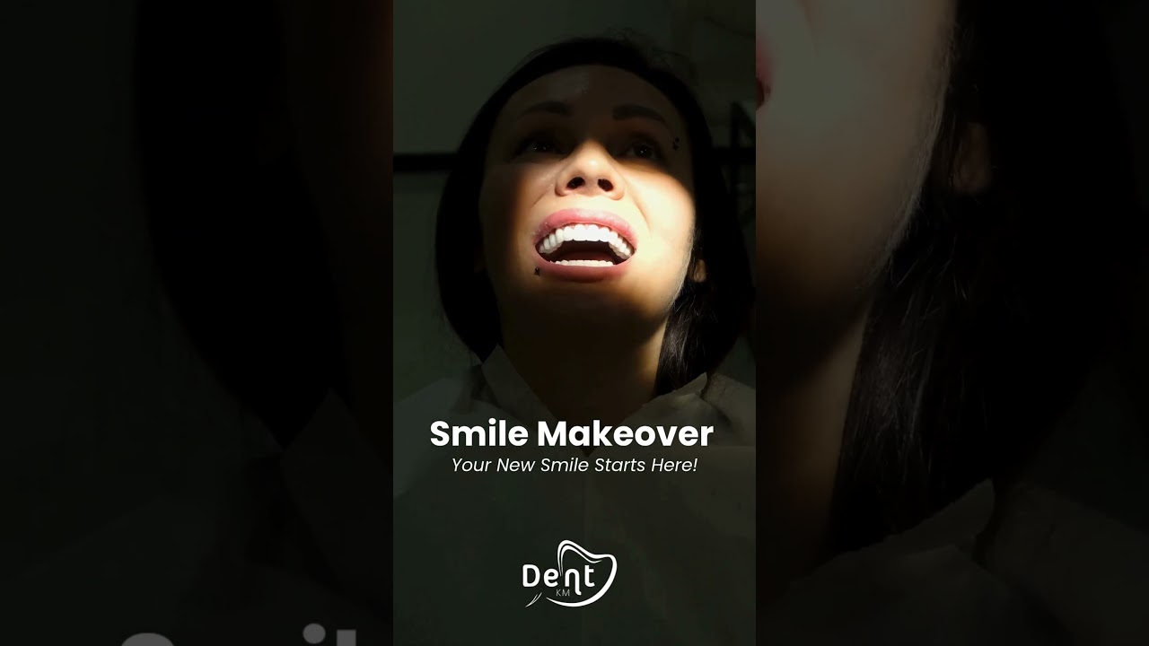 Smile Makeover, Dental Treatment Izmir, Turkey |&nbsp;Dentkm Gaziemir Dental Clinic #smilemakeover
