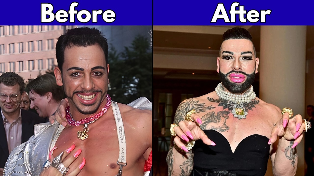 Famous Celebrities were looking Good before Plastic Surgery | Then vs Now