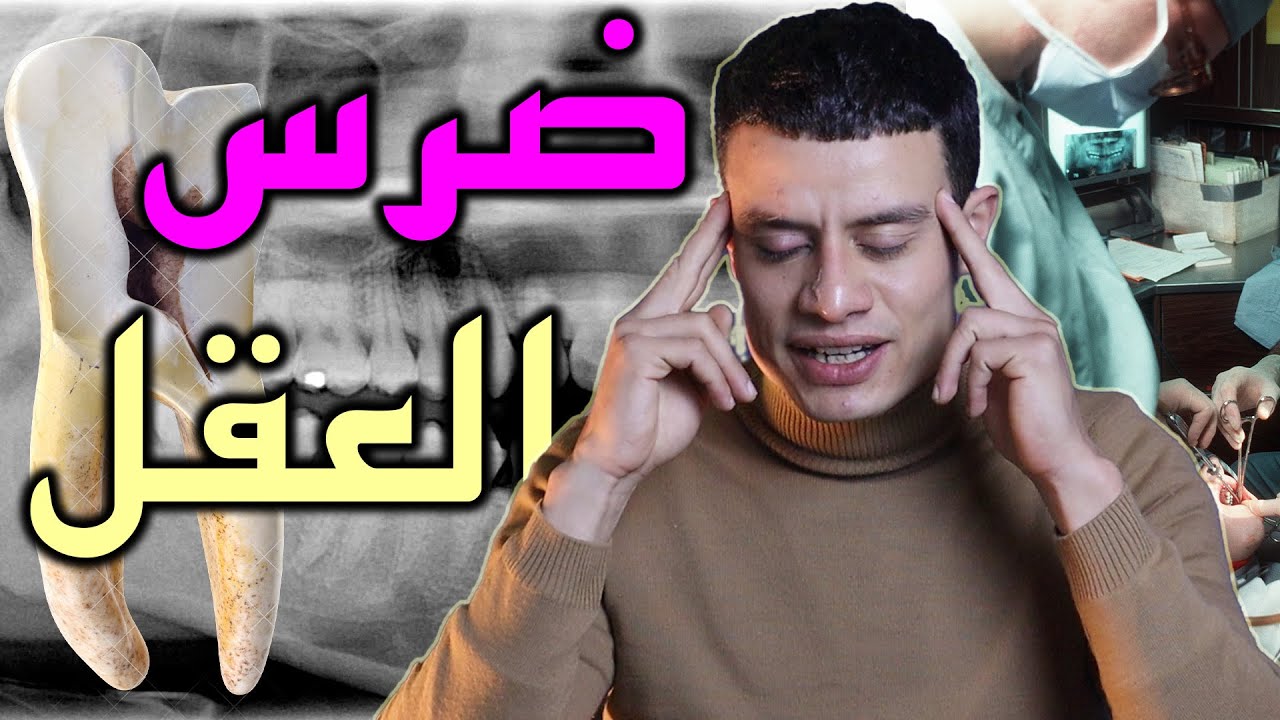 سر ضرس العقل لي عذب بزاف منا !!! 🤯 🤯