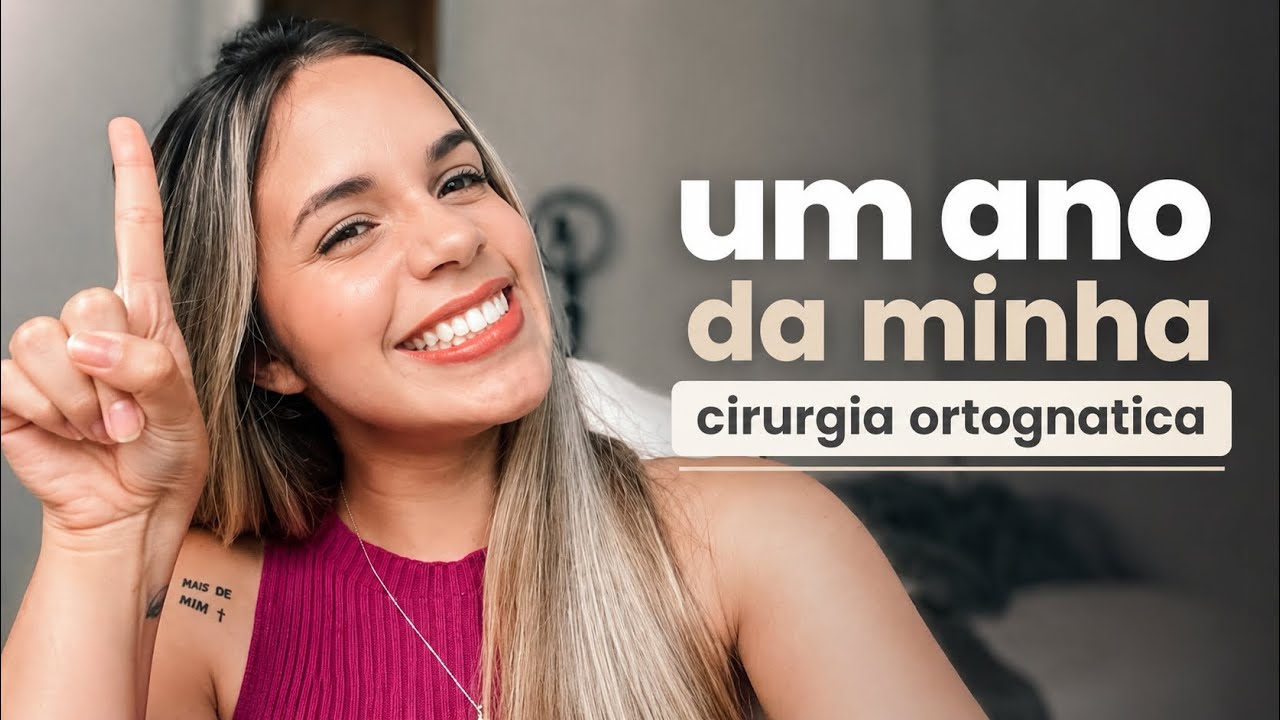 Como eu estou depois de um ano da ortognática? | Cirurgia Ortognática