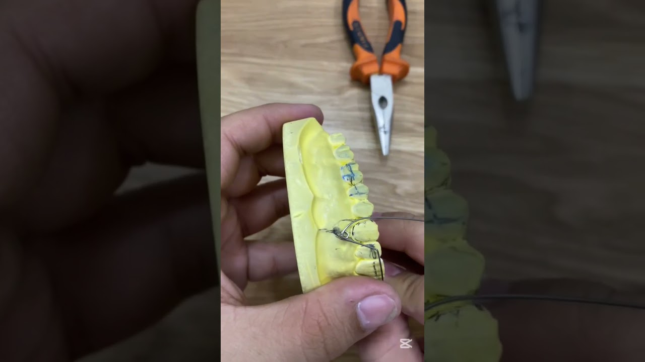 Robert retractor