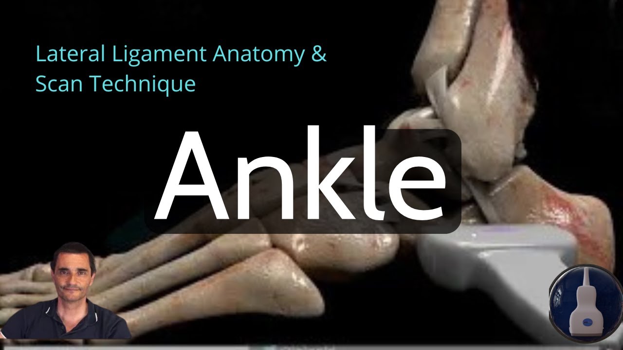 ANKLE ULTRASOUND | Lateral Ligament Anatomy & Scan Technique (PART I)