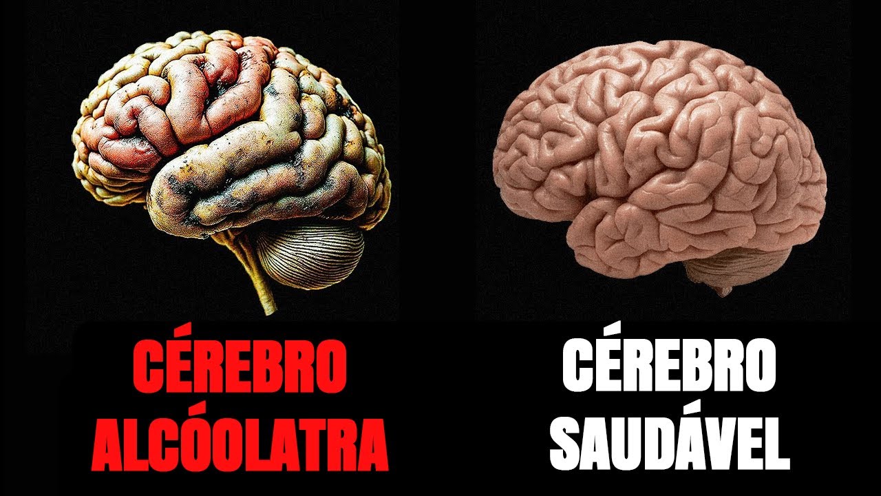 Como o &aacute;lcool afeta o c&eacute;rebro humano (CI&Ecirc;NCIA EXPLICADA)