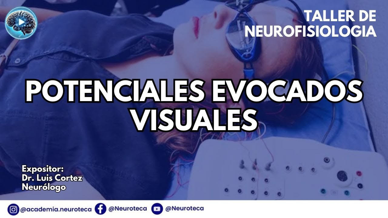 POTENCIALES EVOCADOS VISUALES
