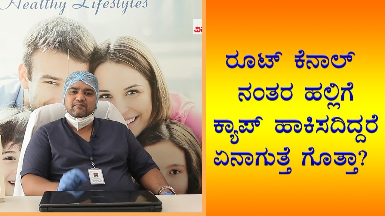 Is a Dental Crown Required After a Root Canal? | Vijay Karnataka