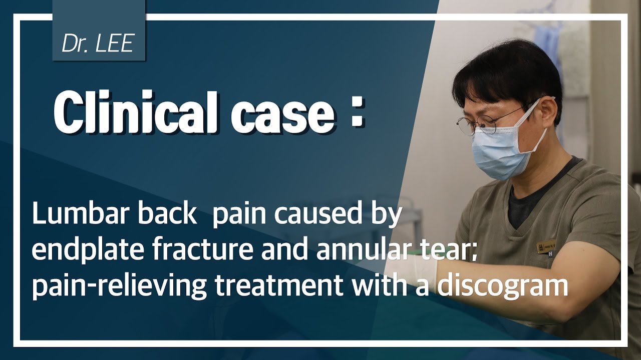 Clinical case: lumbar; discogenic pain for endplate fracture;  discogram; C arm ; basic
