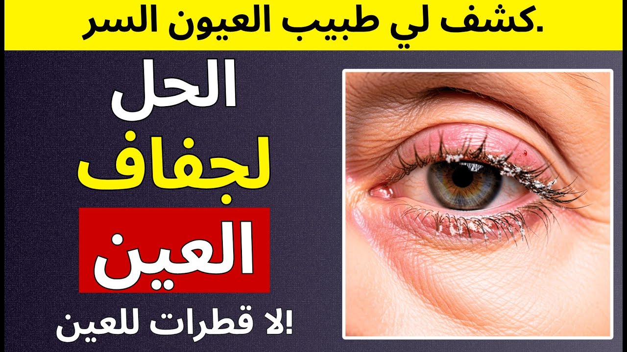علاج جفاف العين طبيعيًا: 7 طرق بسيطة (بدون قطرات)