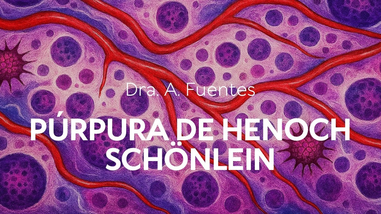 Púrpura de Henoch Schönlein Dra A  Fuentes