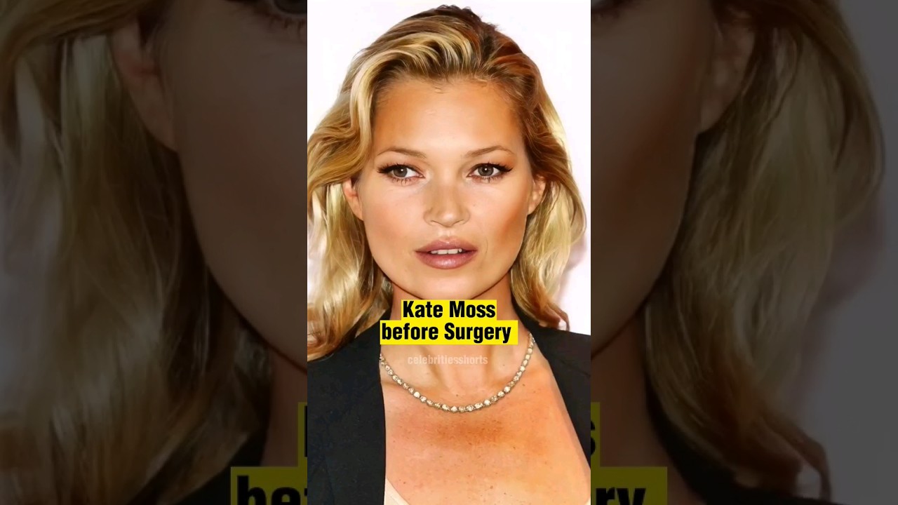 Kate Moss Before Surgery 🤔🤔