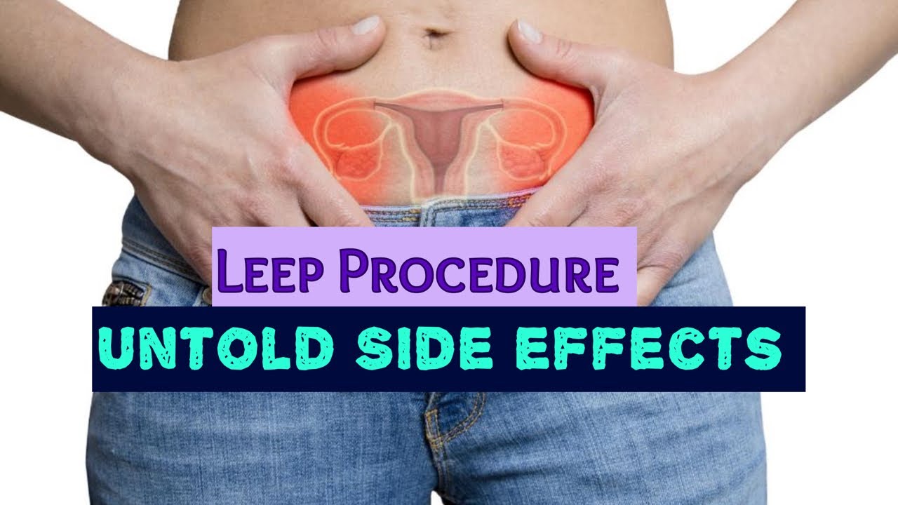 Leep procedure awareness- Let's talk about it