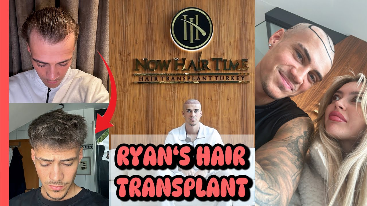 RYAN BEKOMMT EINE HAARTRANSPLANTATION 🫣😱 - ISTANBUL WIR KOMMEN 🇹🇷