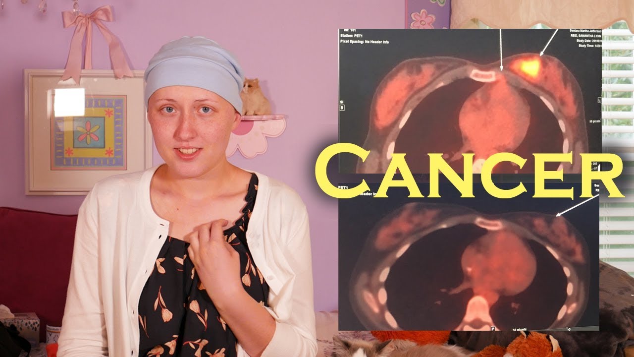 Scan Results & Surgery Decision | My Cancer Story
