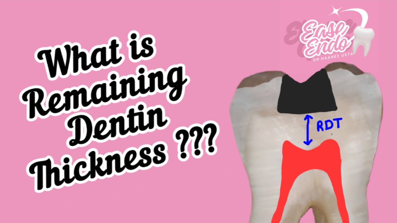 What is Remaining Dentin Thickness? 