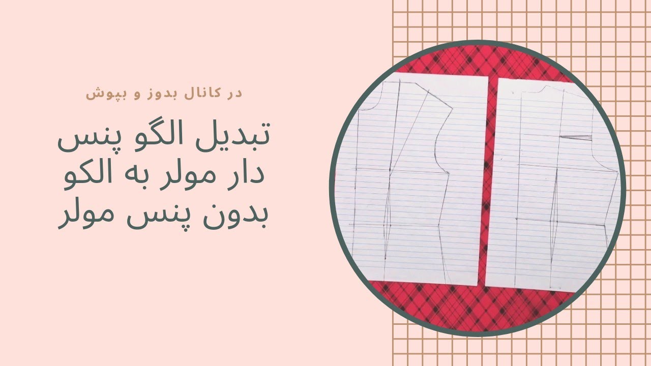 تبدیل الگو پنس دار مولر به الگو بدون پنس