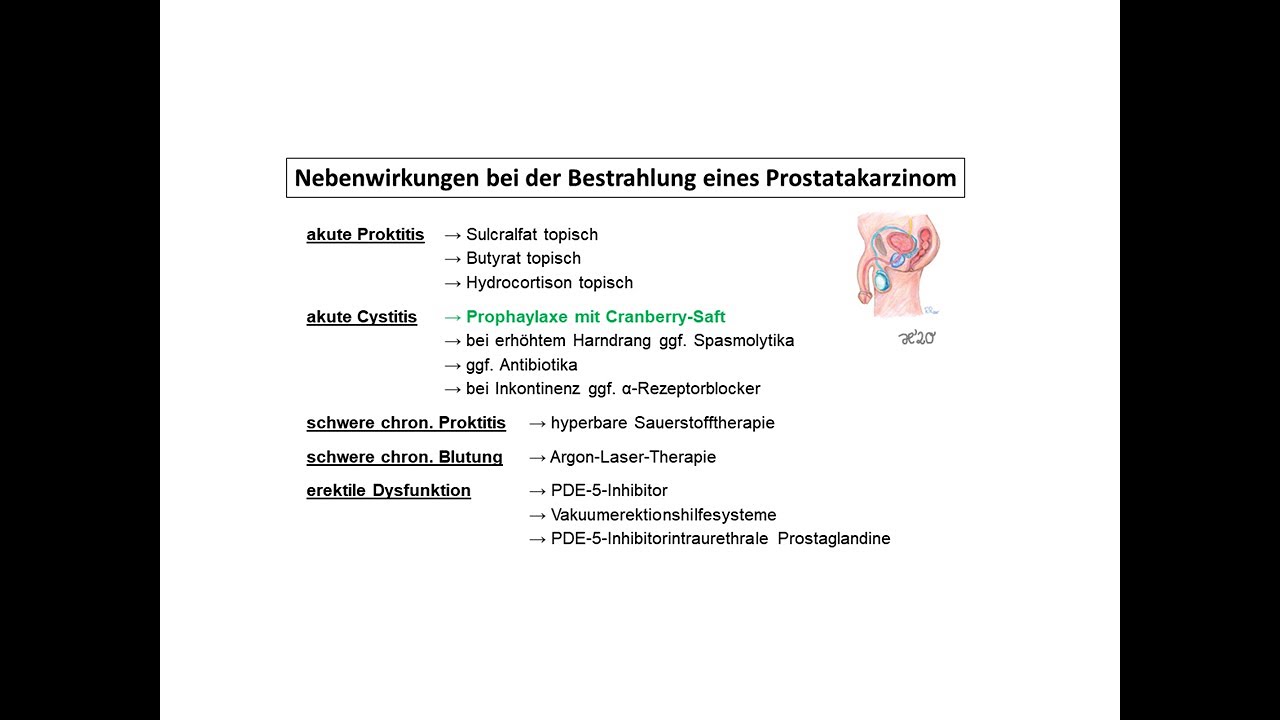 Nebenwirkungen bei der Bestrahlung eines Prostatakarzinoms | Strahlentherapie Prof. Hilke Vorwerk
