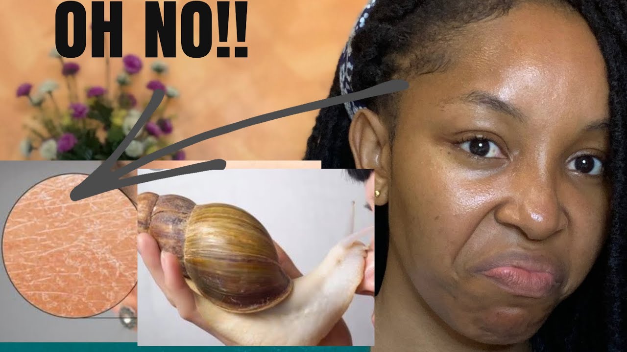I APPLIED SNAIL MUCIN ON MY FACE FOR 7DAYS & THIS HAPPENED+ KOREANS MADE ME DO IT
