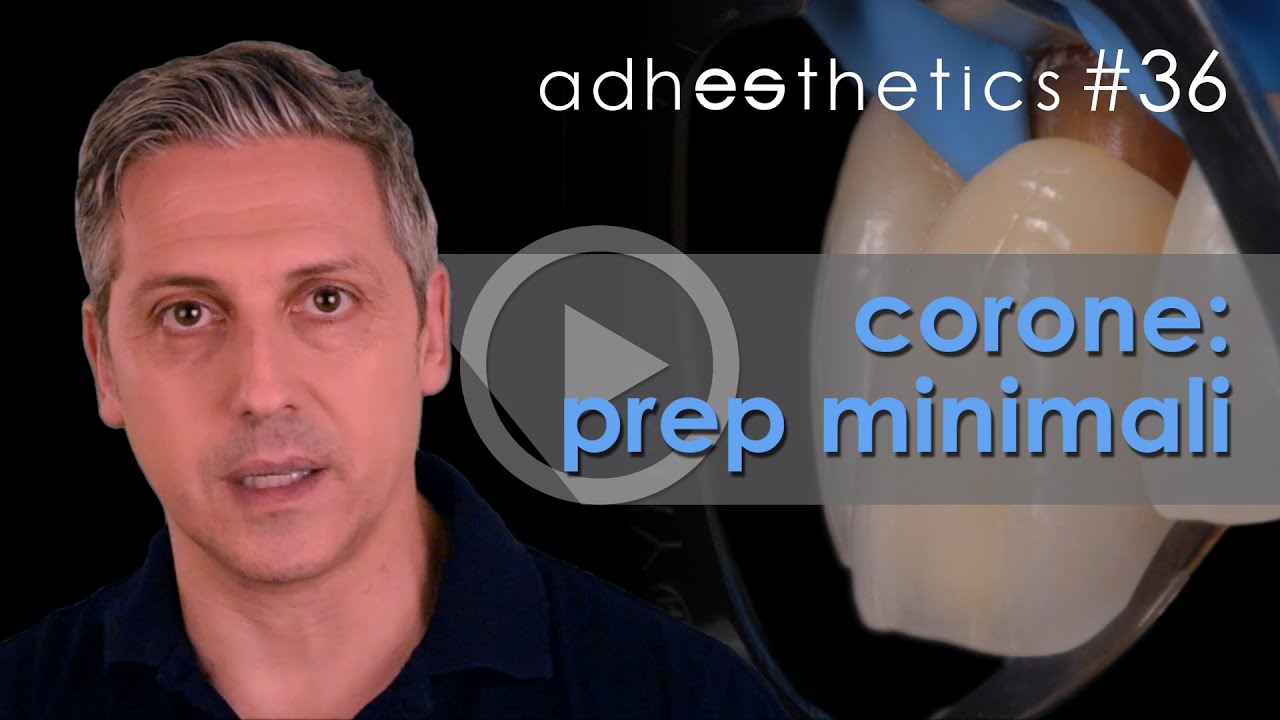 🇮🇹 Corone: preparazioni minimali_corto#36 ITA_Adhesthetics Protocols