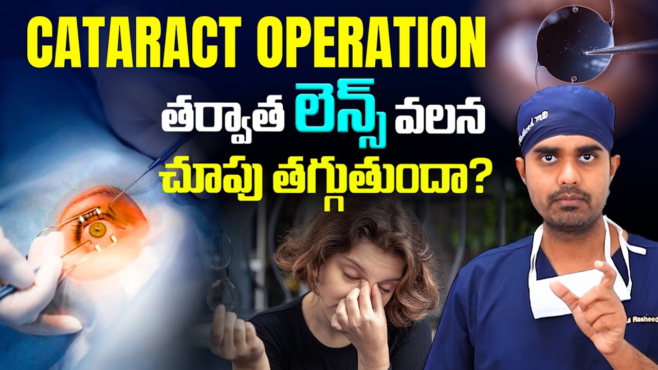 Cataract Lens Side Effects | కంటి శుక్లాల సర్జరీ తర్వాత లెన్స్ సమస్యలు? నిజమా? | Dr Abdul Rasheed
