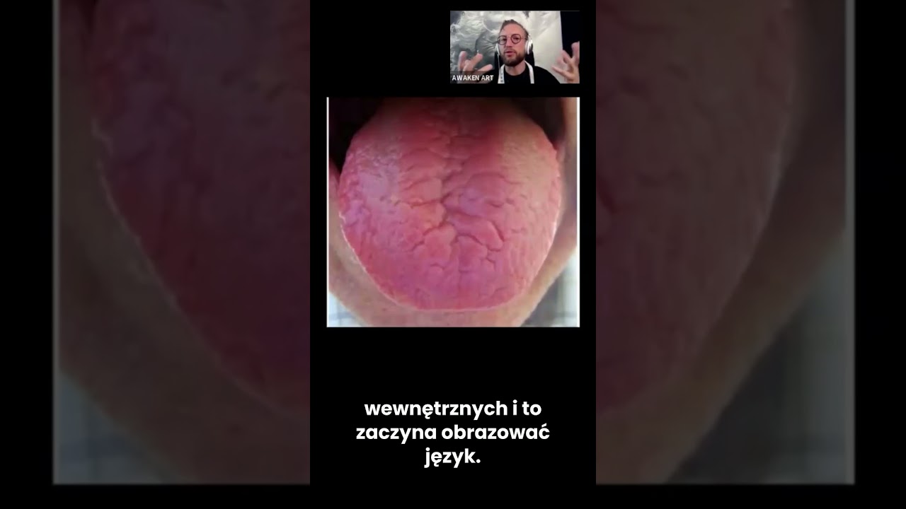 Język ujawnia brak r&oacute;wnowagi yin i yang. Zobacz, jak zioła mogą przywr&oacute;cić harmonię! #shorts