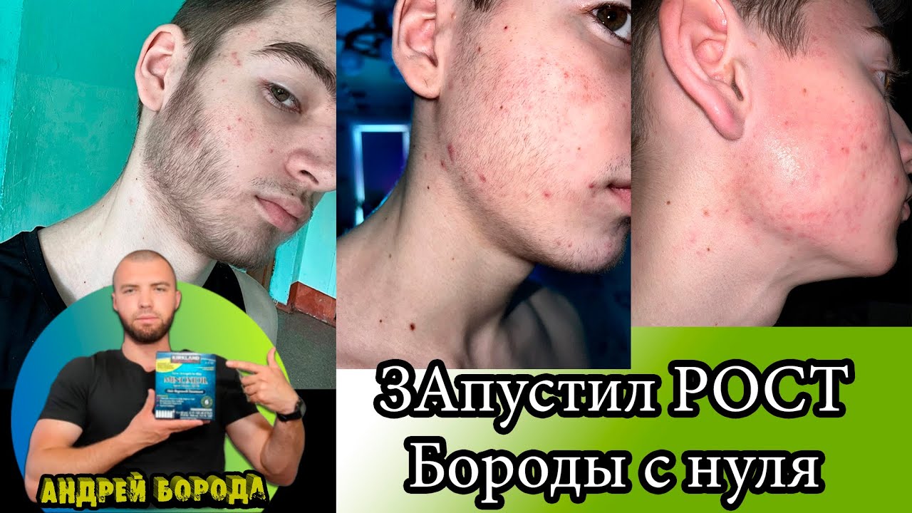 Как запустить рост бороды если вам 19 лет / Выпуск №2 / Андрей борода