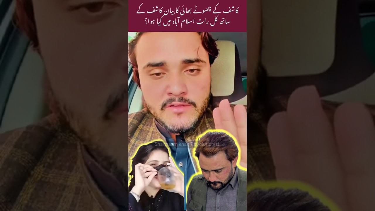گیلہ منہ اور کاشف علی اصل حقیقت