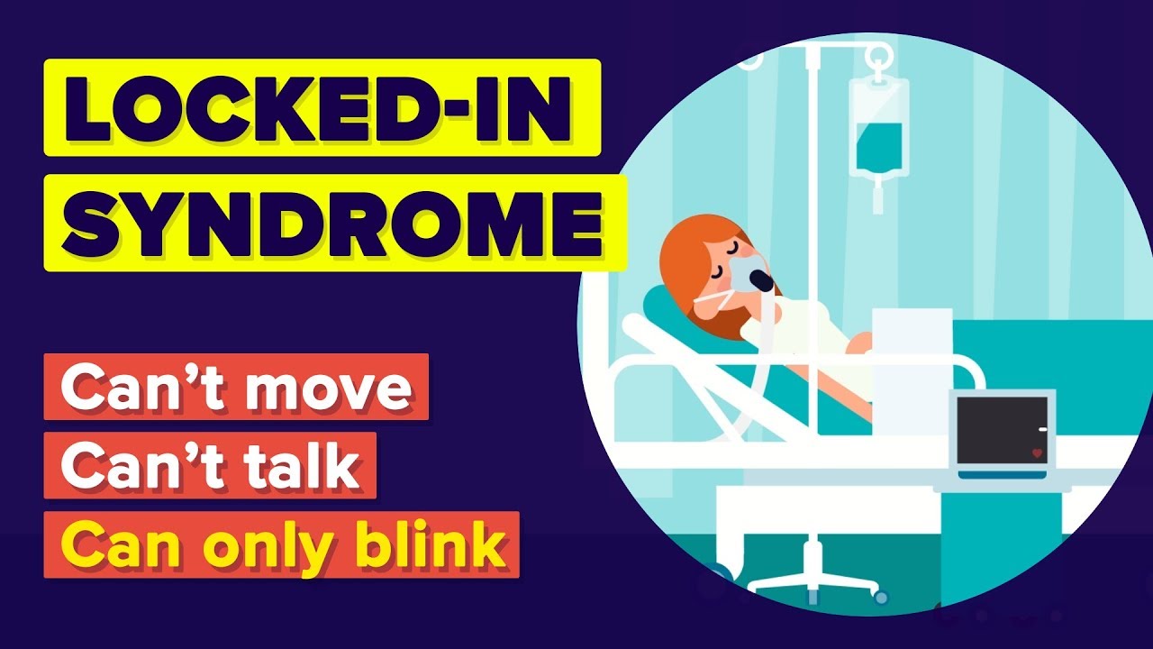 What Is Locked-in Syndrome? Worst Thing That Can Happen To You!