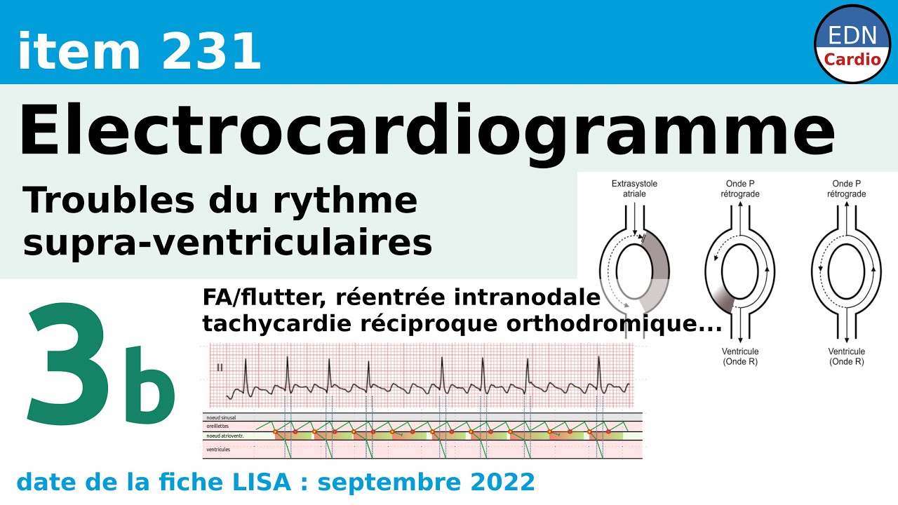 231 - Electrocardiogramme (ECG) - Partie 3b - Troubles du rythme supra-ventriculaires