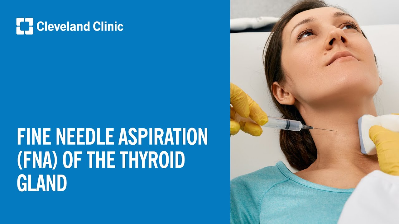 Fine Needle Aspiration (FNA) of the Thyroid Gland