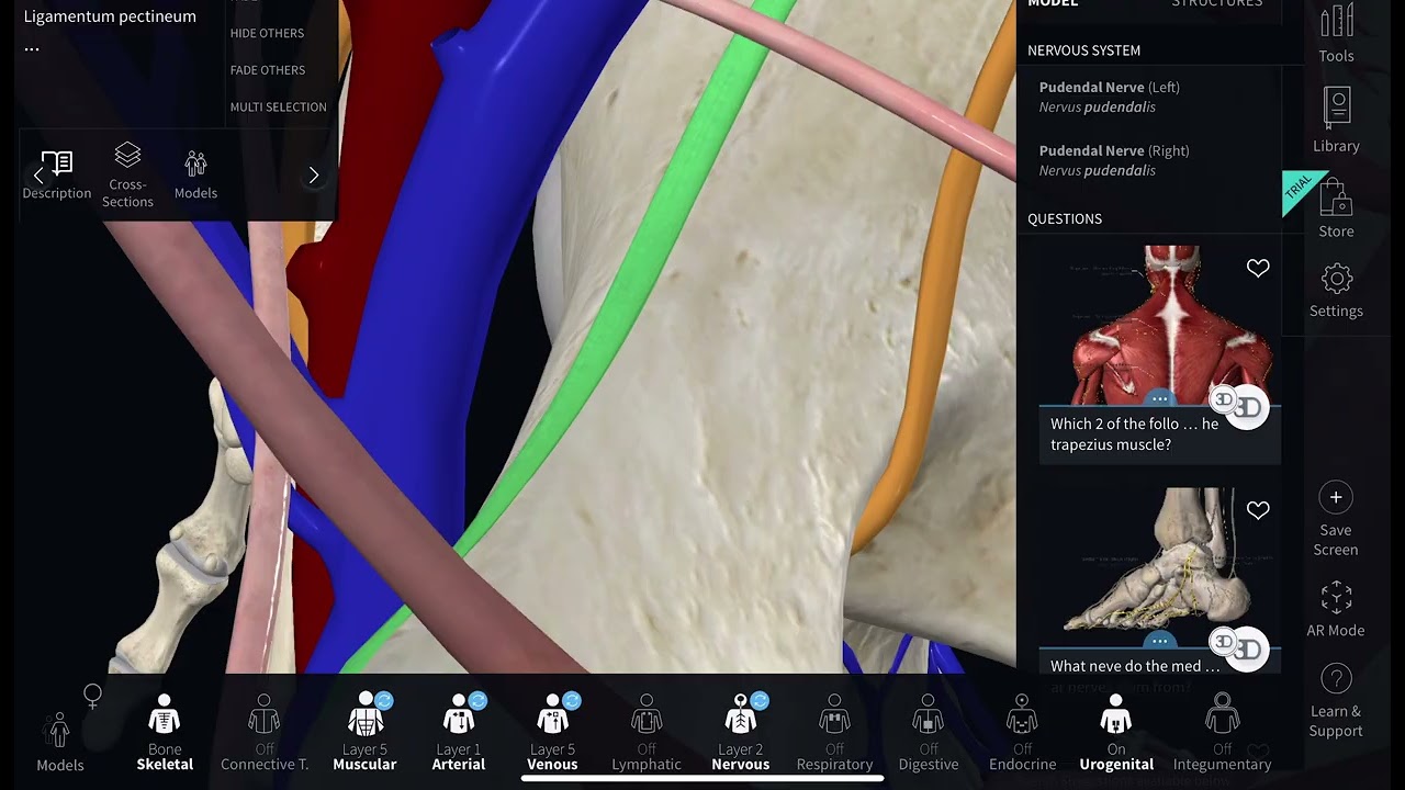 Anatomical Complication of Burch colposuspension
