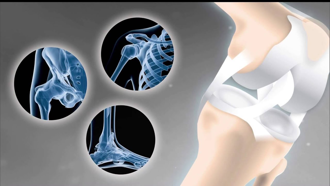 Clinical Trial Offers Hope For Knee Pain Suffers!