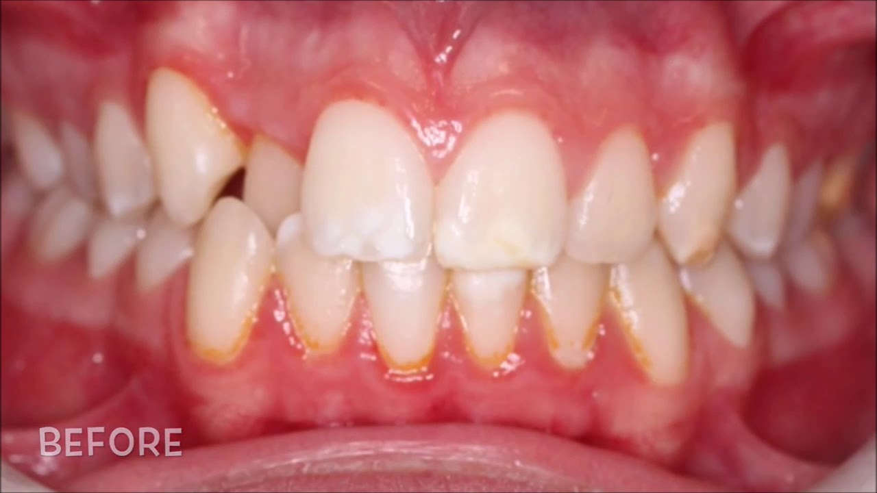 10 traitements chez l'orthodontiste