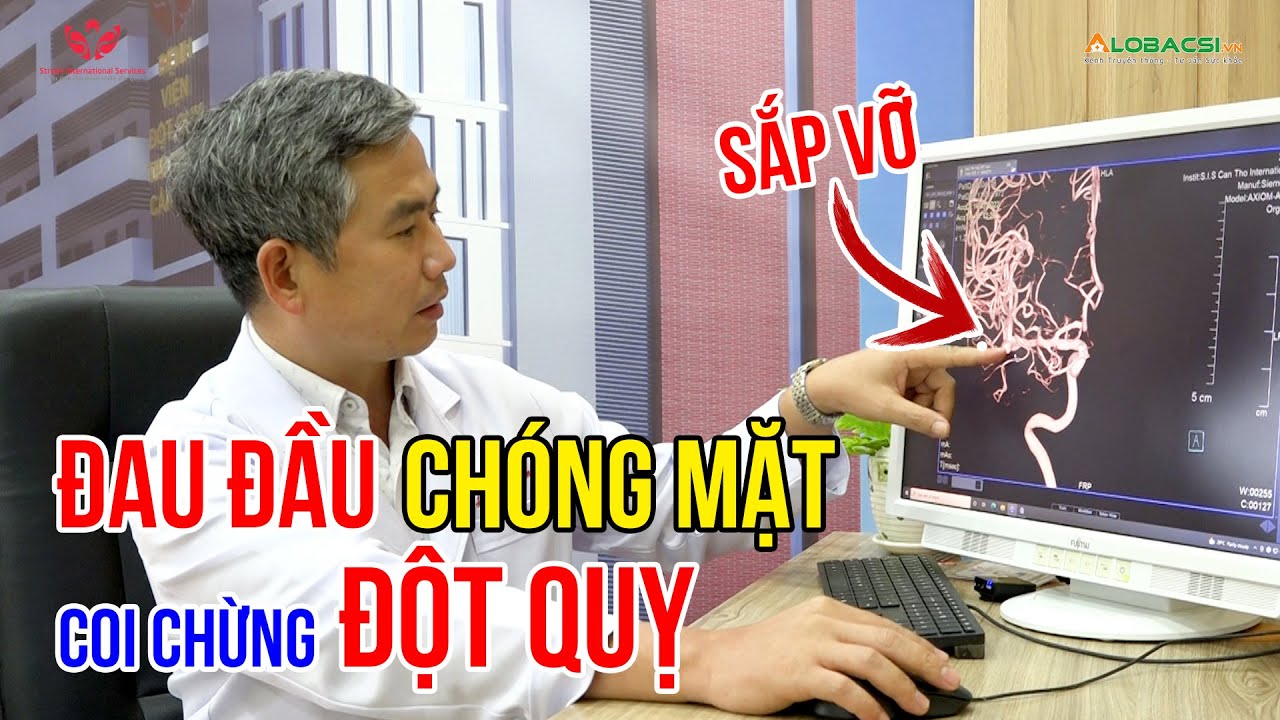 Đau đầu chóng mặt dai dẳng, cảnh giác với túi phình mạch máu não | Video AloBacsi