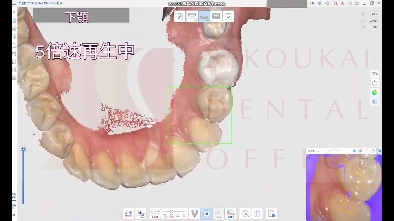 MEDITi600スキャン（ジョーモーション）