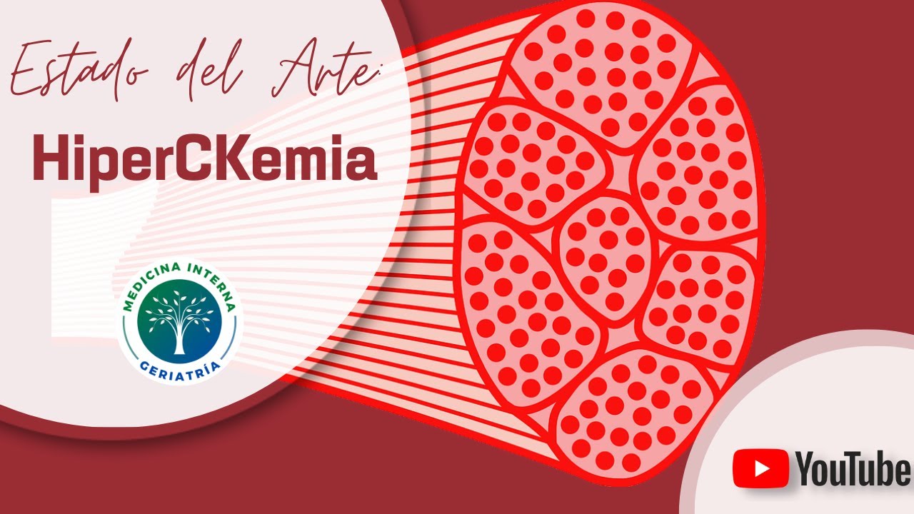 hiperCKemia