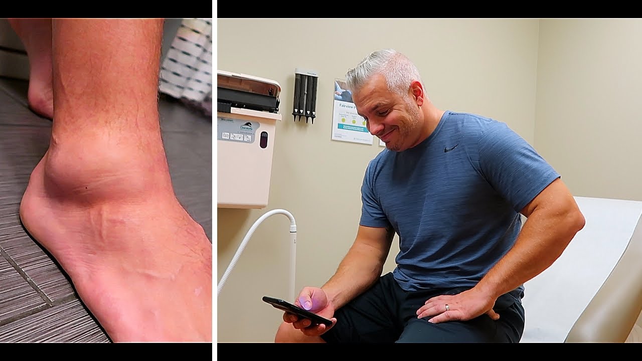BROKEN ANKLE?! |💉OMNIPOD CHANGE |
